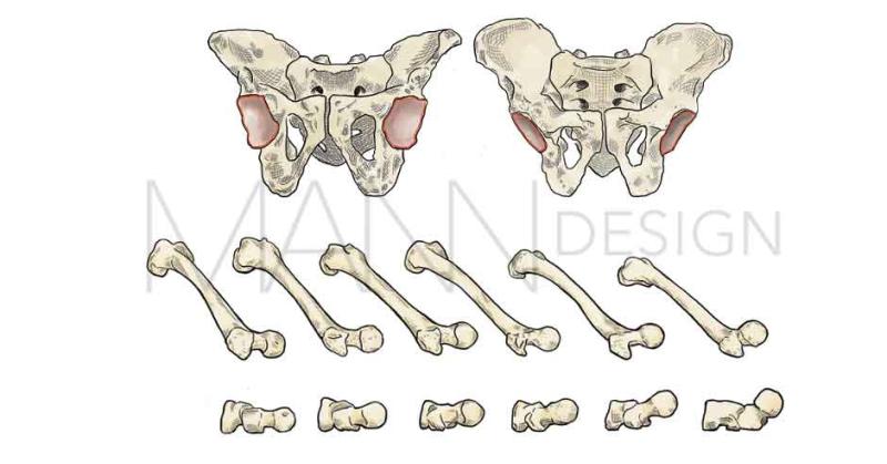 Bone shape variations